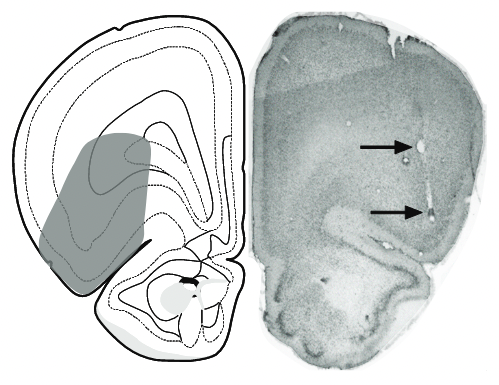 Anatomical location of recording sites